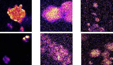 How Does Quantum Microscope Work