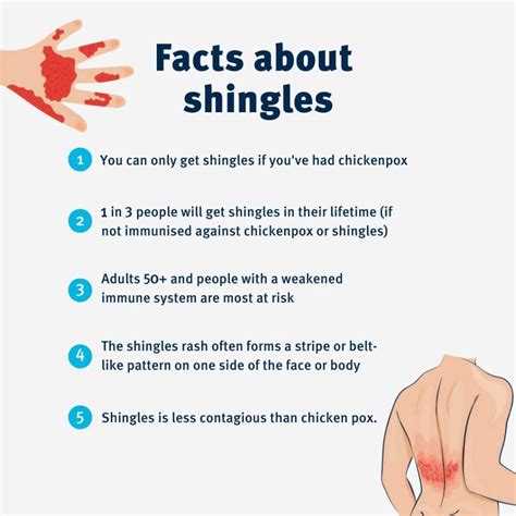 how does someone catch shingles