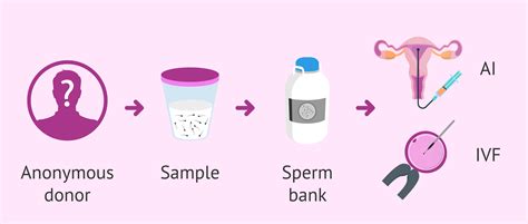 how does sperm donation work for women