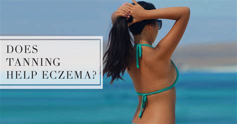 How Does Tanning Help Eczema