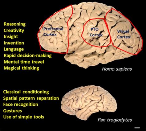 how does the brain recognize patterns