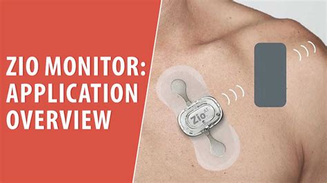 How Does The Zio Patch Work