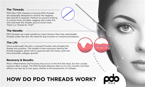 How Does Threading Work