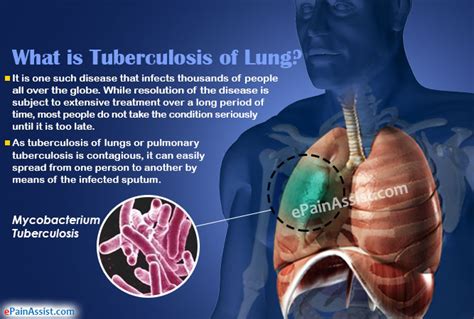 how does tuberculosis work