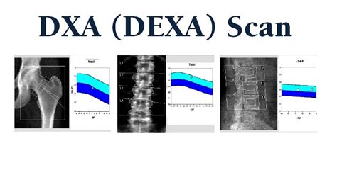 Unlocking the Power of Digital X-ray: Understanding How DXA Works