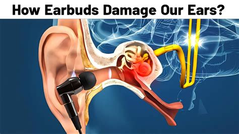 how earbuds damage ears