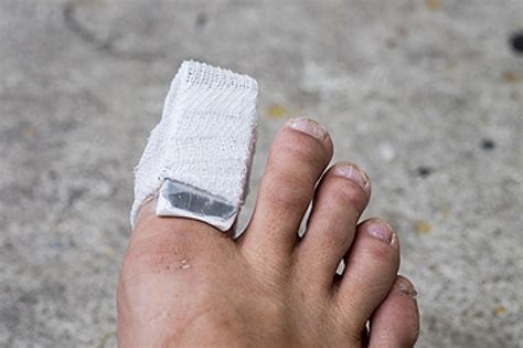 how fast does a broken toe heal