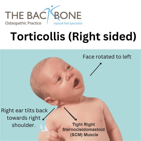 how fragile is a newborn's neck