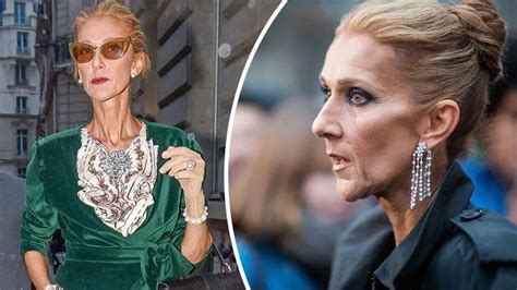 how is celine dion's health in 2024