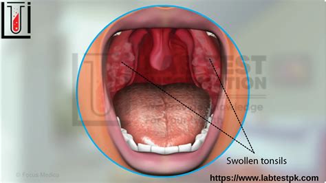 How Is Mono Transmitted