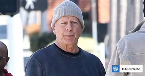 how is the health of bruce willis