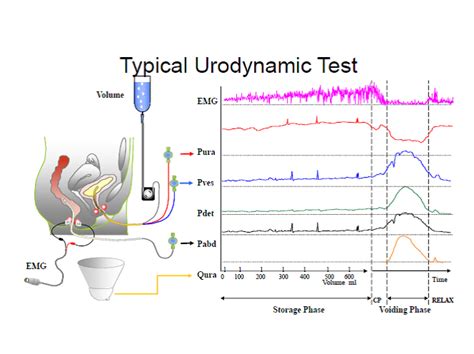 how is urodynamic study done