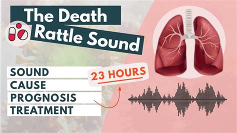 How Long After The Death Rattle Starts Does Someone Die
