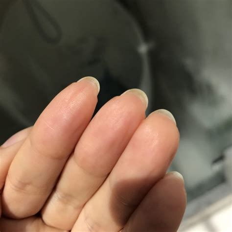 The How Long Are Nails Under The Skin For New Style