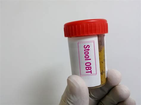 how long can a stool sample be kept in fridge