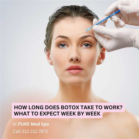 How Long Did It Take Your Botox To Work