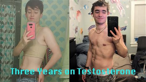 How Long Do Ftm Take Testosterone