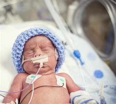 how long do preemies need oxygen