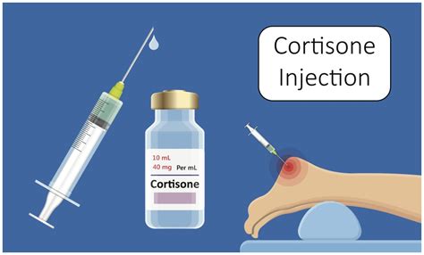how long does a cortisone injection take to work