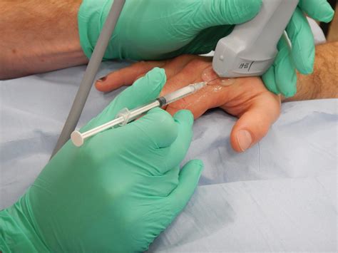 how long does a steroid injection take to work in dogs