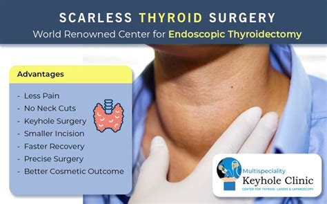 H1: How Long Does a Thyroidectomy Surgery Take? A Comprehensive Guide