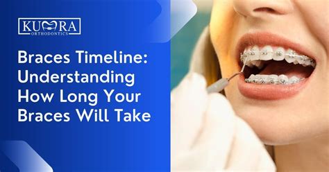 How Long Does Braces Adjustment Take