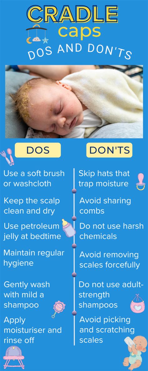 How Long Does Cradle Cap Last On Face