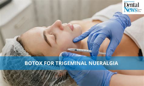 how long does it take botox to work for trigeminal neuralgia