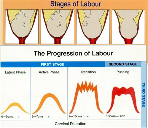 How Long Does It Take Dates To Induce Labor