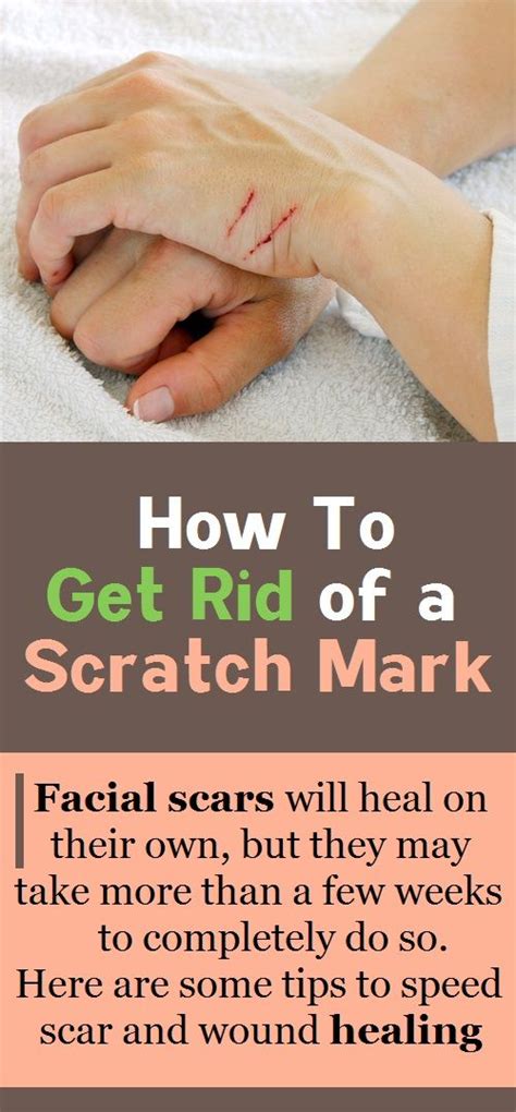 How Long Does It Take For A Surface Scratch To Heal