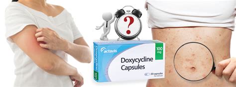 how long does it take for doxycycline to work for bacterial infection