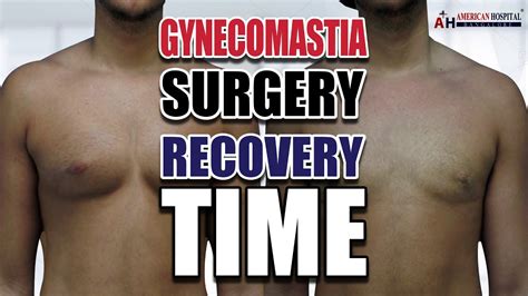 How Long Does It Take For Gynecomastia To Develop
