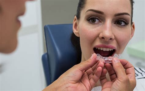 how long does it take for invisalign refinements to come in