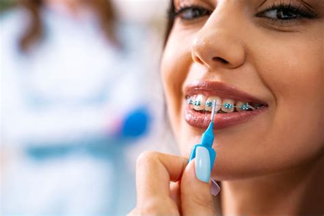 how long does it take for invisalign to start working