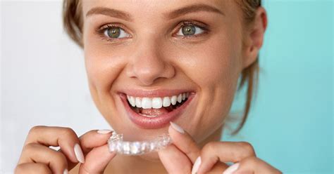 how long does it take for invisalign to work