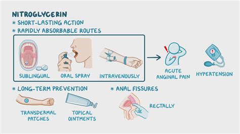 How Long Does It Take For Nitroglycerin Patch To Work
