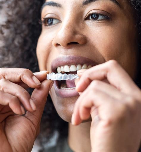 how long does it take to adjust to a new invisalign tray