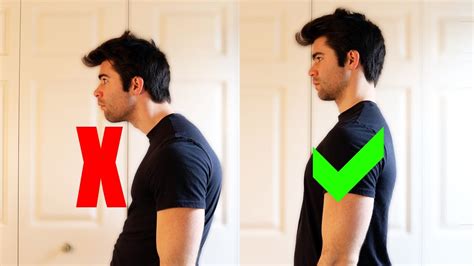 how long does it take to fix nerd neck