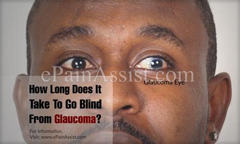 How Long Does It Take To Go Blind In A Cave