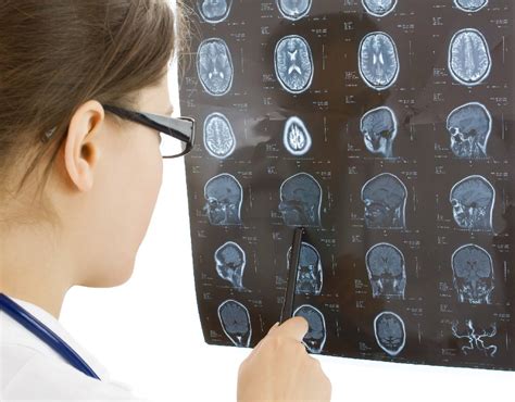 how long does it take to settle a brain injury case