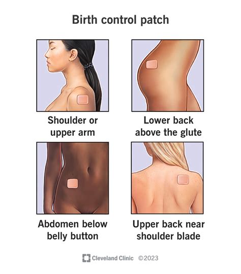 How Long Does The Birth Control Patch Last