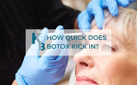 how long for botox to kick in reddit