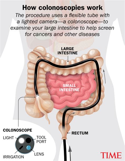 How Long Is a Colonoscopy Procedure: Average Duration Explained