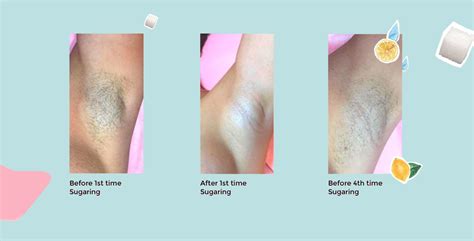  79 Popular How Long Should Armpit Hair Be For Sugaring With Simple Style