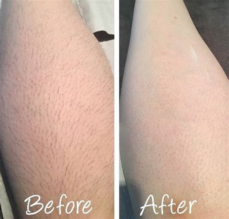 This How Long Should Leg Hair Be For Waxing With Simple Style