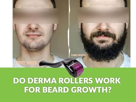 Derma Roller for Beard Treatment for Boosting Your Beard Growth