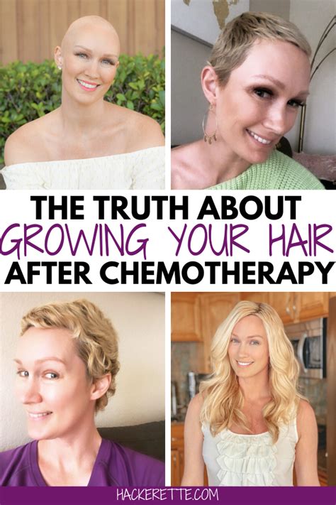 Free How Long To Grow Hair Out After Chemo For Long Hair