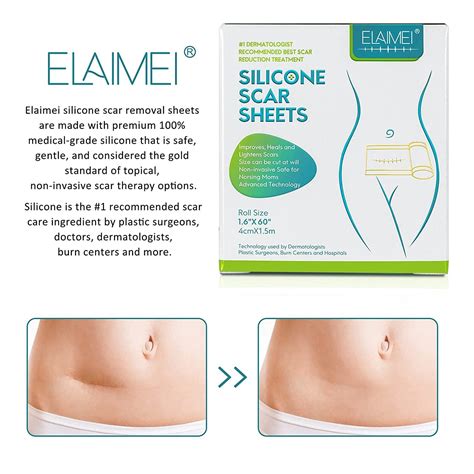 how long to use silicone scar sheets after c section