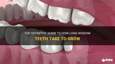 how long wisdom teeth grow