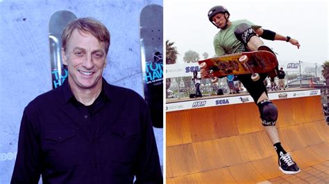 how many bones has tony hawk broken